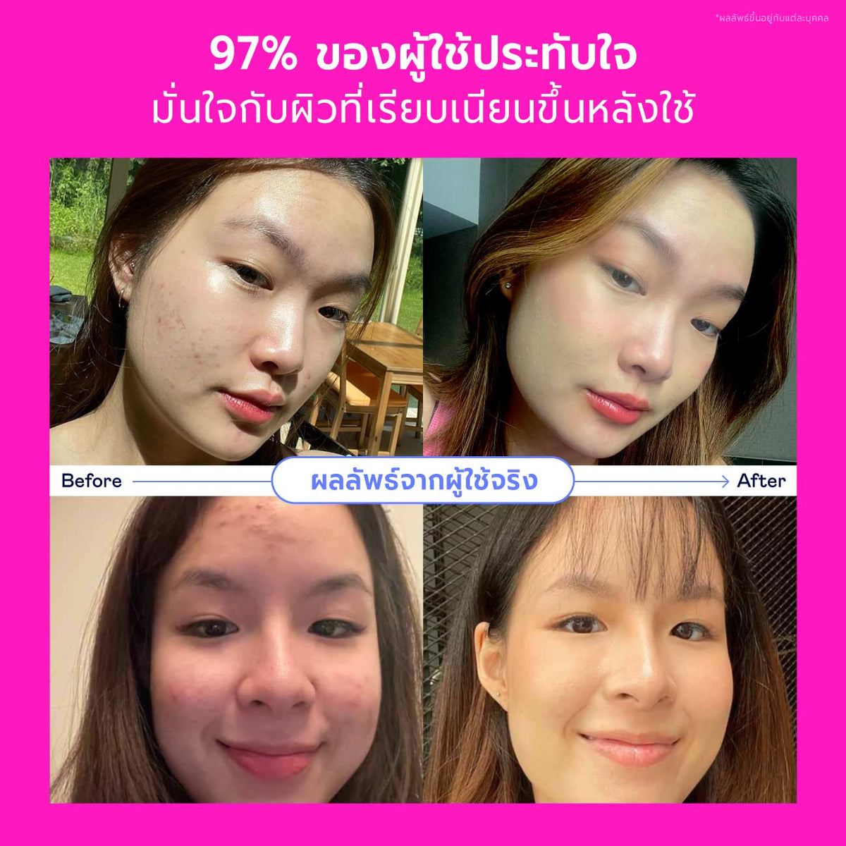 Songkran Skincare Set