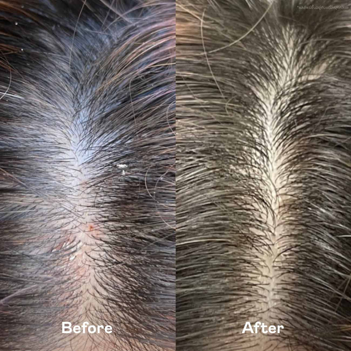 Scalp Routine