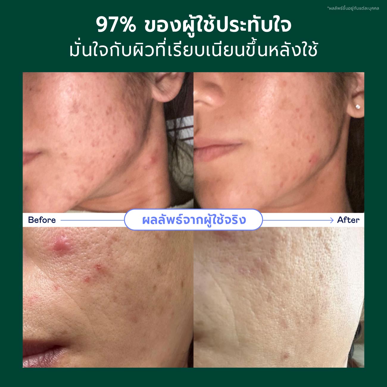 Christmas Skincare Gift Set