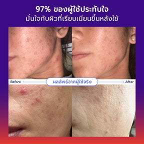 Skincare Promo Set