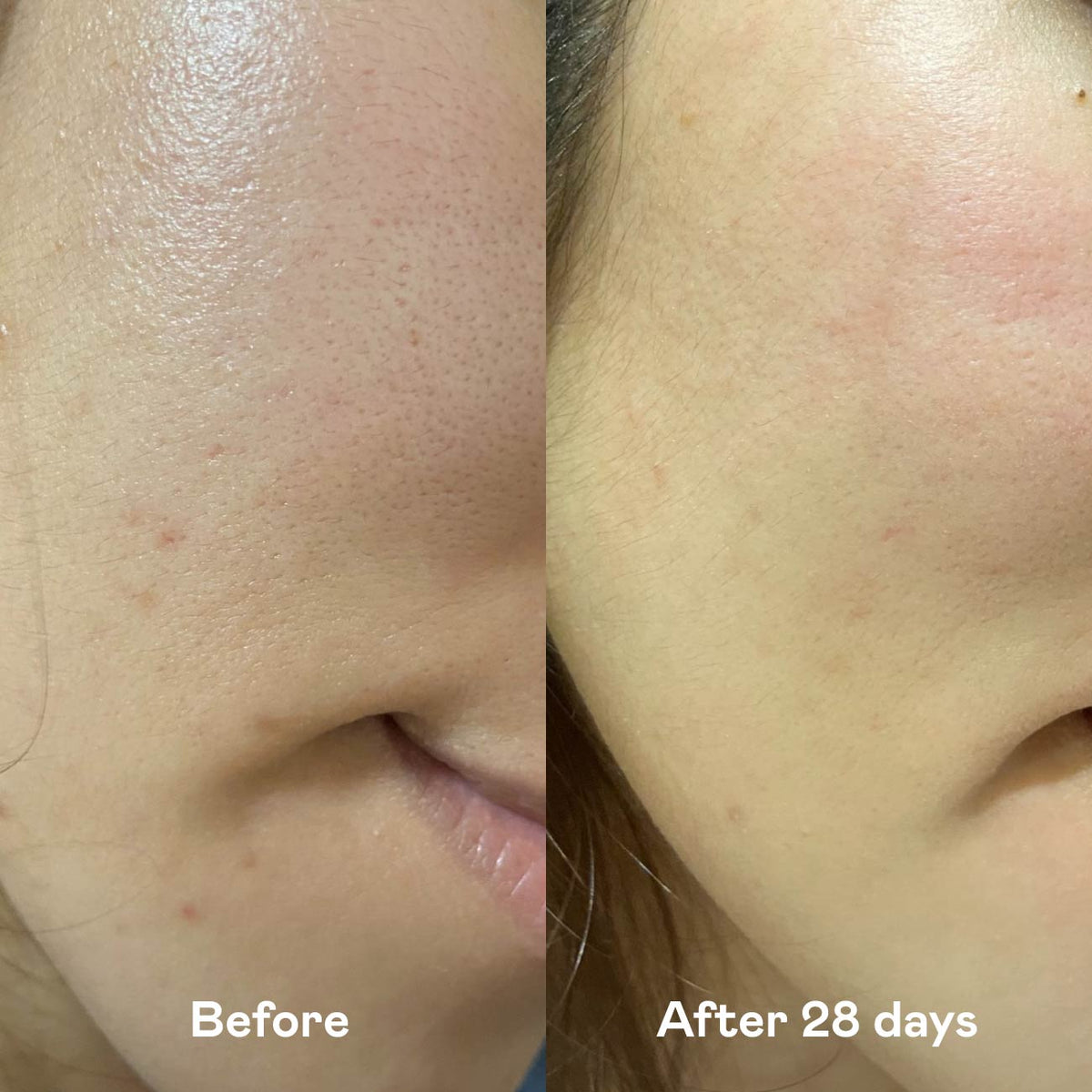 Serum & Mask Duo